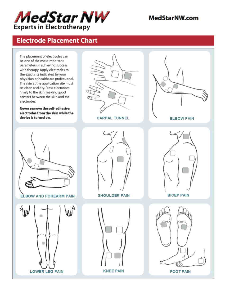 Electrode Placement Guidelines, TENS Electrode Chart